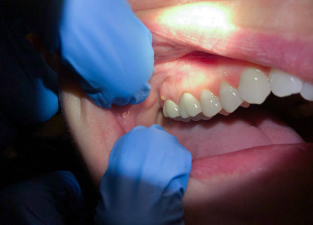 Best Dentist for Dental Trauma  in Geronimo, OK
