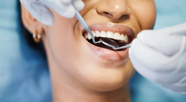 Best Teeth Whitening  in Geronimo, OK
